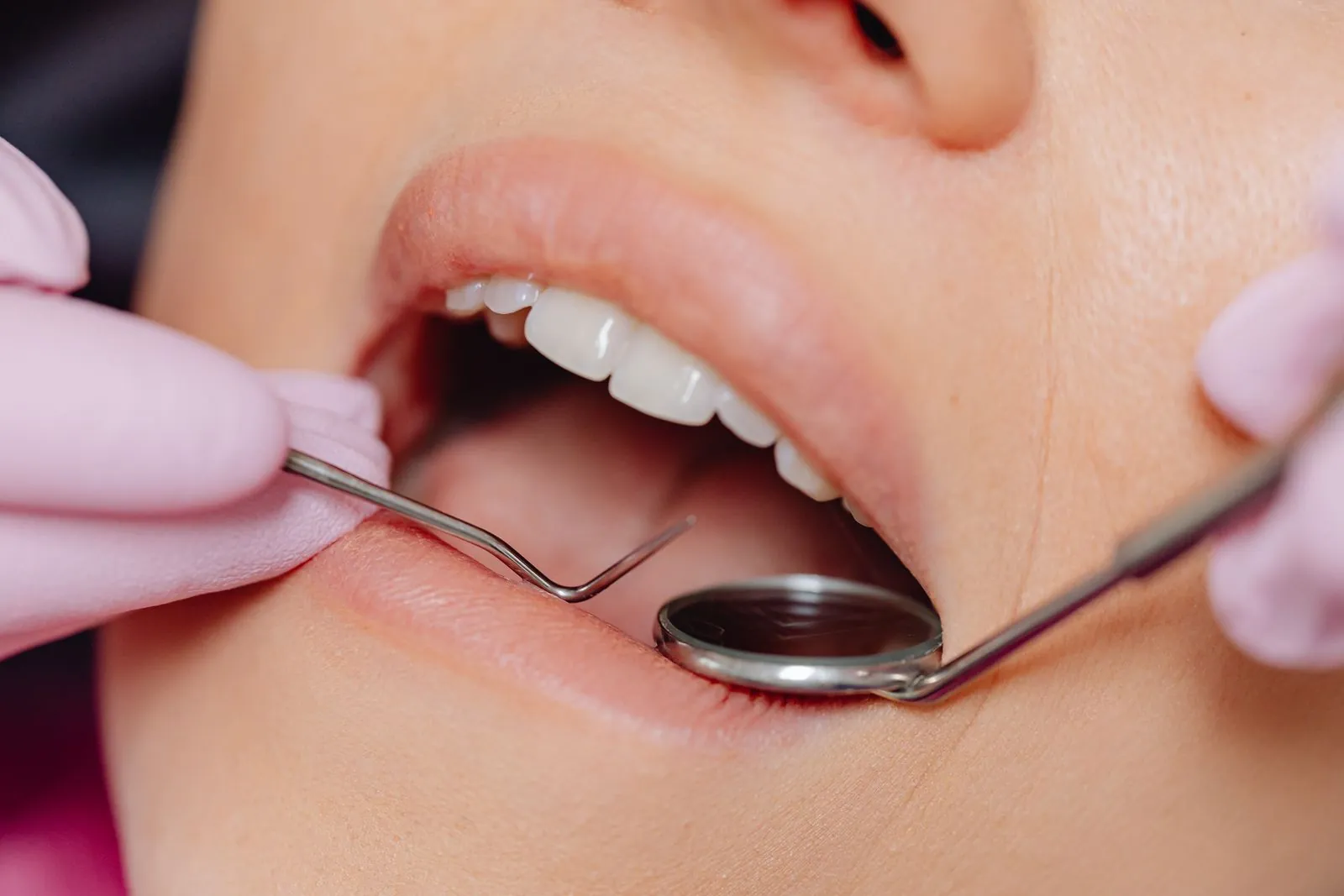 Endodonzia