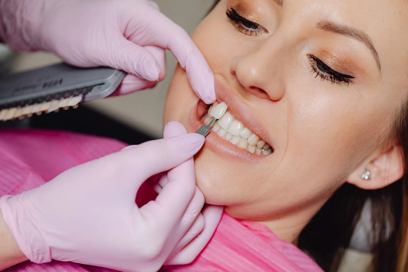 Estetica Dentale